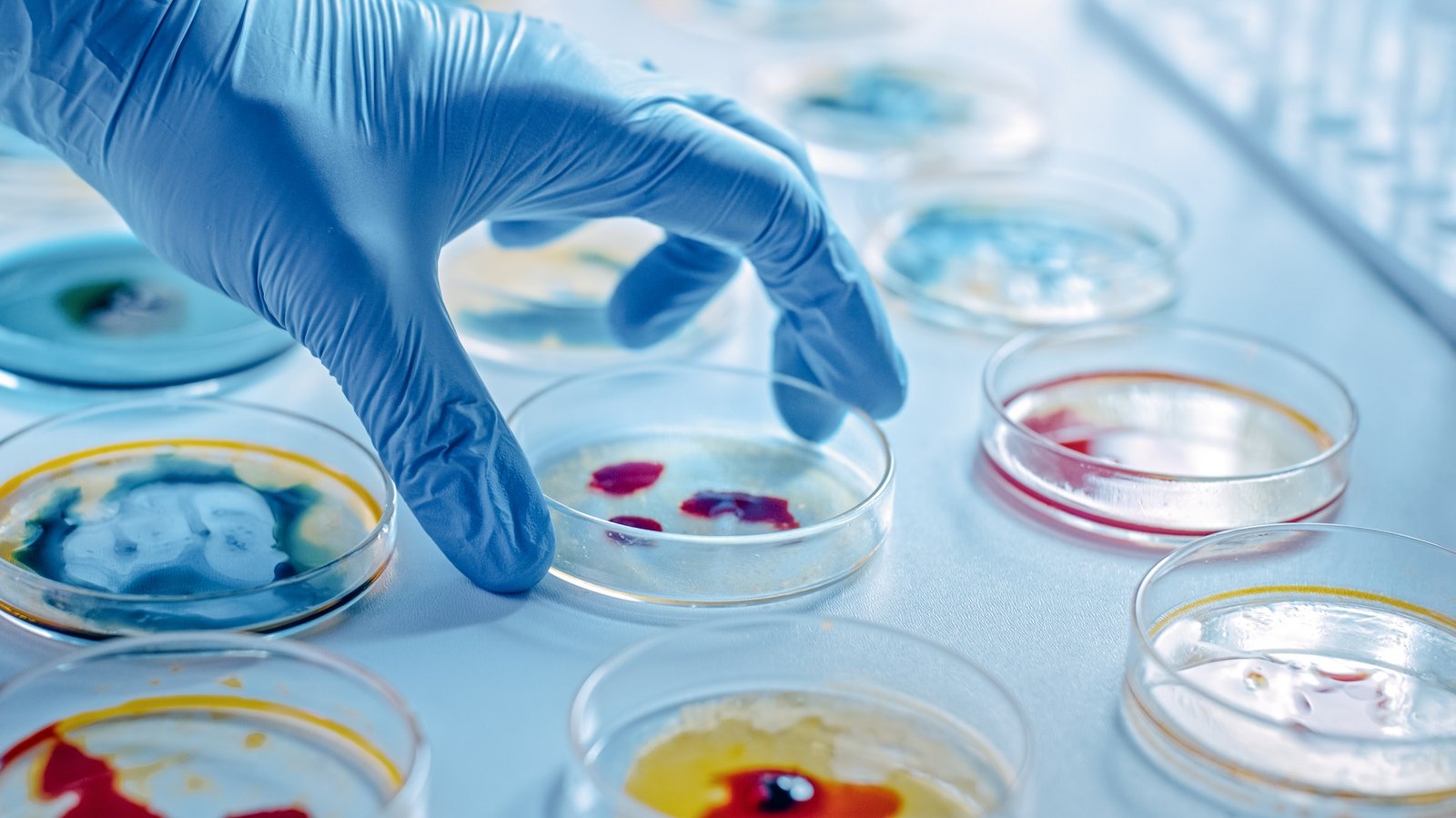 Microbiology Research & Infectious Diseases